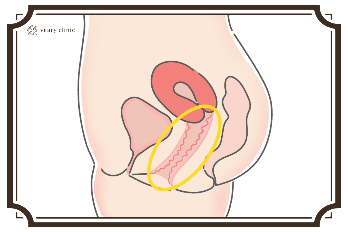 女性器における名器とは 種類や特徴と名器の作り方 コラム一覧 公式 ヴェアリークリニック