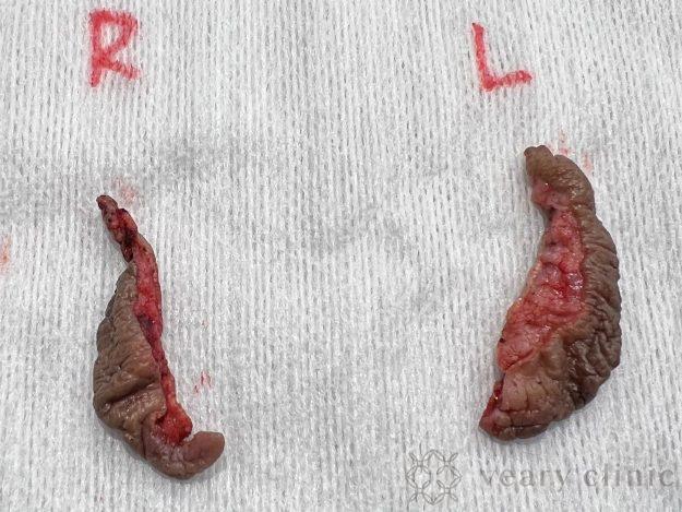 カットした小陰唇