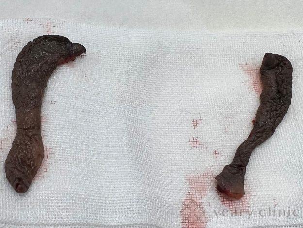 カットした小陰唇