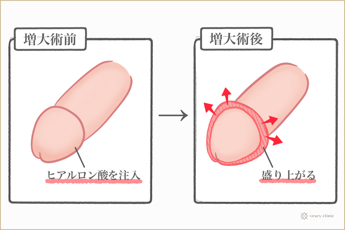 カリ 刺激