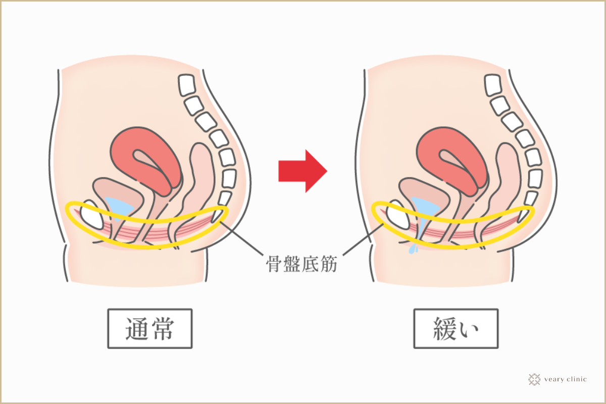処女膜 