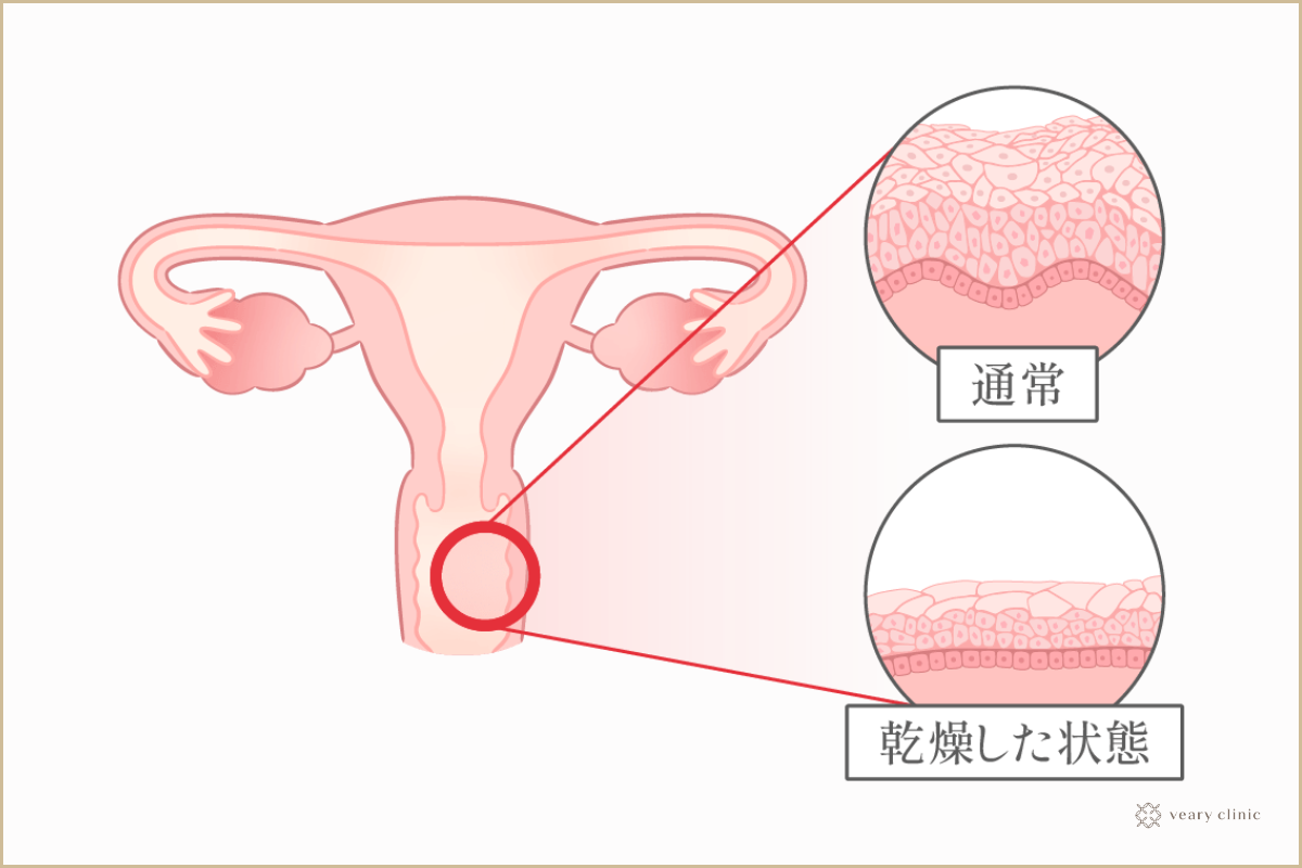 コラムA6-3